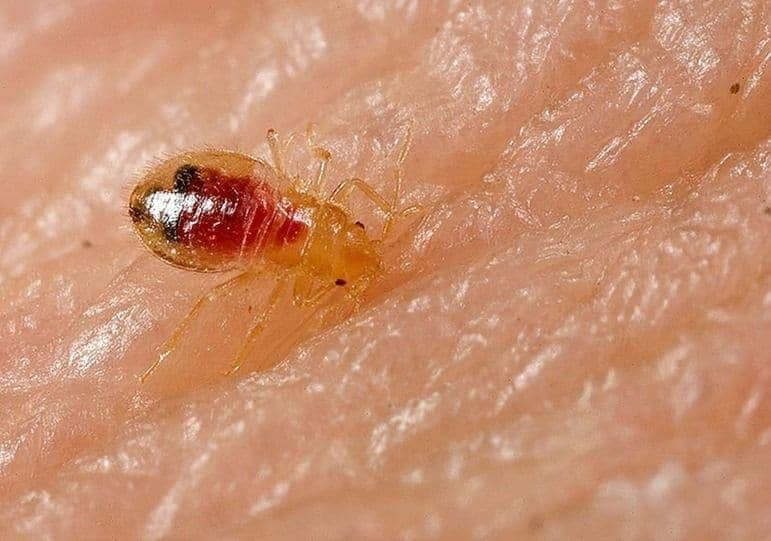How to Get Rid of Bed Bugs While Traveling - Destinationless Travel